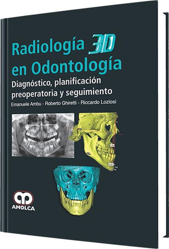 Radiología 3d En Odontología Diagnóstico Planificación Pero