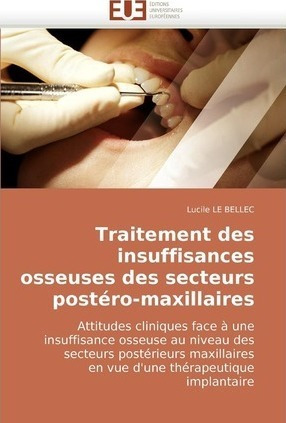 Traitement Des Insuffisances Osseuses Des Secteurs Poster...