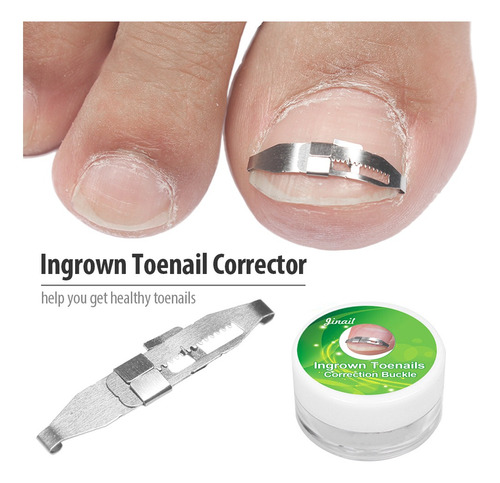 Herramienta De Tratamiento De Corrección De Uñas Encarnadas