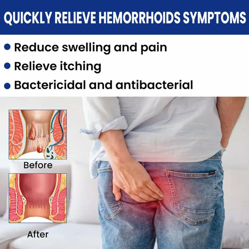 3× Crema For Hemorroides, Crema For Eliminar Hemorroides