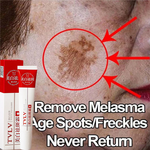 Crema Blanqueadora Para Pecas, Removedor De Manchas Oscuras
