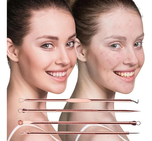 Kit Removedor Extractor Puntos Negros Espinillas Acne 4 Pzs