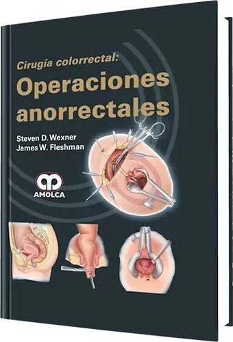 Cirugía Colorrectal Operaciones Anorrectales Wexner.