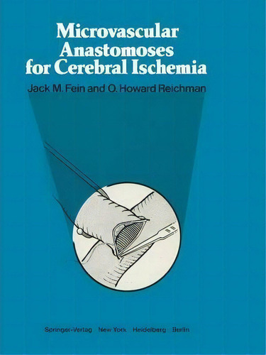 Microvascular Anastomoses For Cerebral Ischemia, De Jack M. Fein. Editorial Springer Verlag New York Inc, Tapa Blanda En Inglés