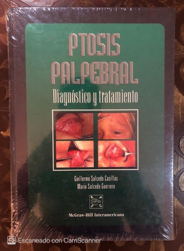 Libro Ptosis Palpebral Diagnostico Y Tratamiento