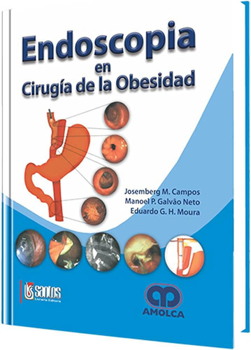 Endoscopia En Cirugia De La Obesidad