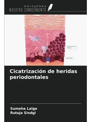 Cicatrización De Heridas Periodontales