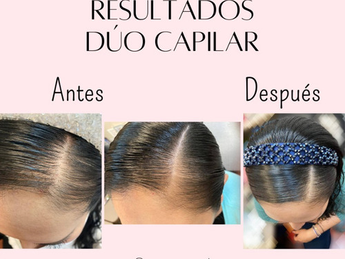 Tratamiento Anticaida 125ml/loción Estimulador Crec Cap130ml