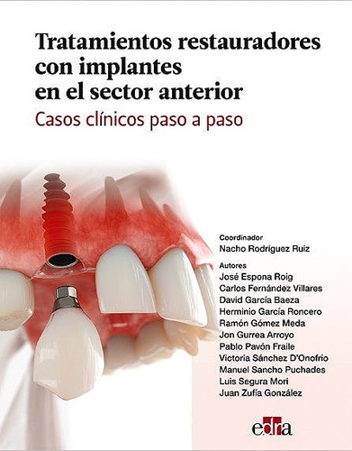 Libro Tratamientos Restauradores Con Implantes En El Sect...