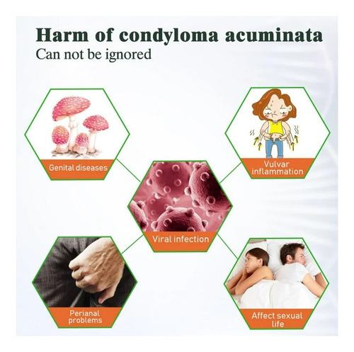 La Crema Para Eliminar Verrugas X Elimina Rápidamente Y Fáci