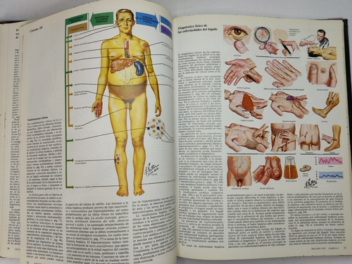 Libro Coleccion Ciba Sistema Digestivo Tomo 3.3 Netter 198b8 (Usado)