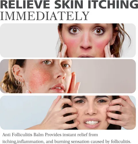 2×crema Hidratante Hidratante Para Eliminar La Foliculitis