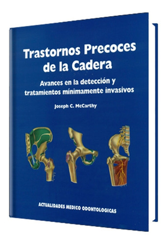 Trastornos Precoces De La Cadera. Avances En La Detección.