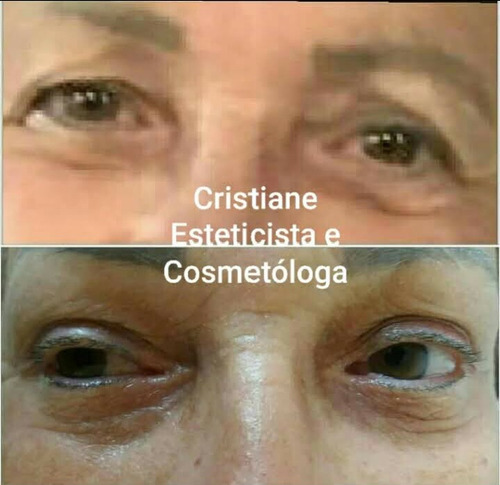 Imagem 1 de 5 de Jato De Plasma
