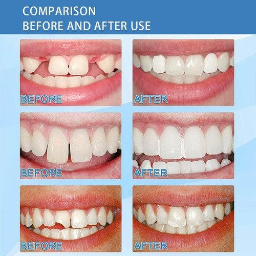 Eelhoe Dientes Postizos Dientes Reparación Gránulos 30ml