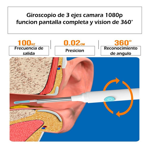 Limpiador De Oidos Con Camara 1080p Kit Eliminacion De Cera