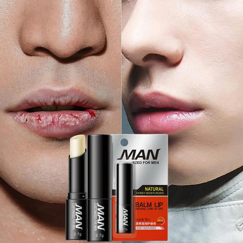 Bioqua Labial Para Hombres  Labios Partidos Hidratacion