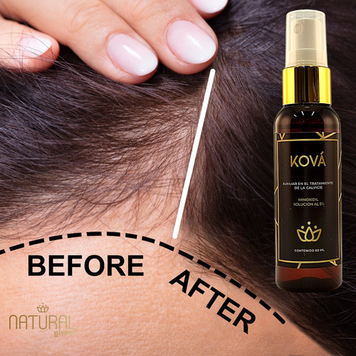 Imagen 5 de 9 de Minoxidil 5% Tratamiento Para Cabello Y Barba 60ml