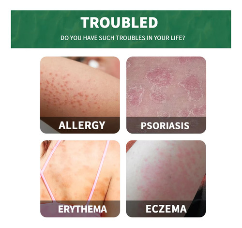 Crema Para La Psoriasis Psorilax 50 Mi Fragancia Neutro