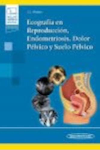 Ecografía En Reproducción, Endometriosis, Dolor Pélvico Y Su