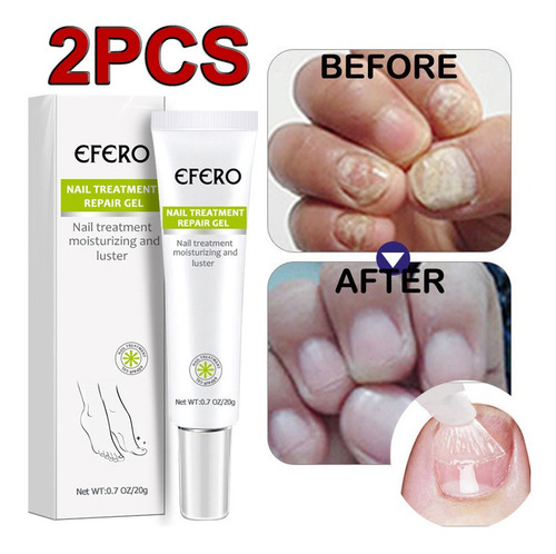 Gel Reparador De Uñas Efero, 2 Unidades, Tratamiento De Uñas