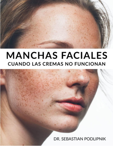 Libro: Manchas Faciales: Cuándo Las Cremas No Funcionan (spa