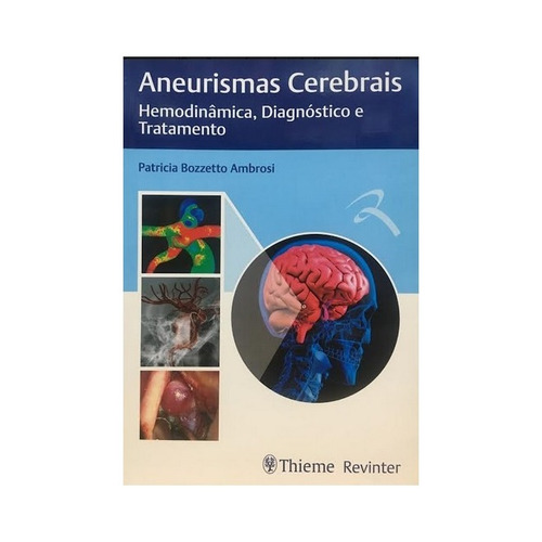 Aneurismas Cerebrais - Hemodinâmica, Diagnóstico E Tratamento