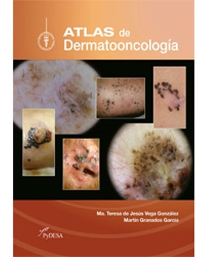 Atlas De Dermatooncologia