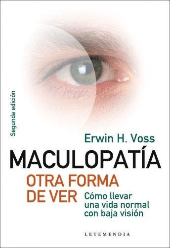 Maculopatia Otra Forma De Ver