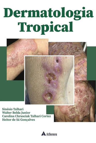 Livro Dermatologia Tropical, 1ª Edição 2022