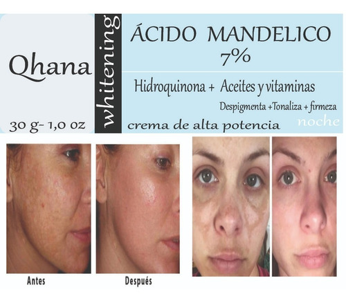 Crema Blanqueadora Piel Sensible 50 G