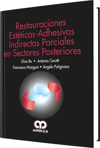 Restauraciones Estéticas-adhesivas Indirectas Parciales