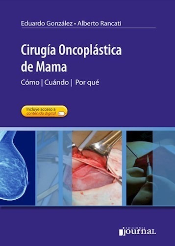 Libro - Cirugía Oncoplástica De Mama González !