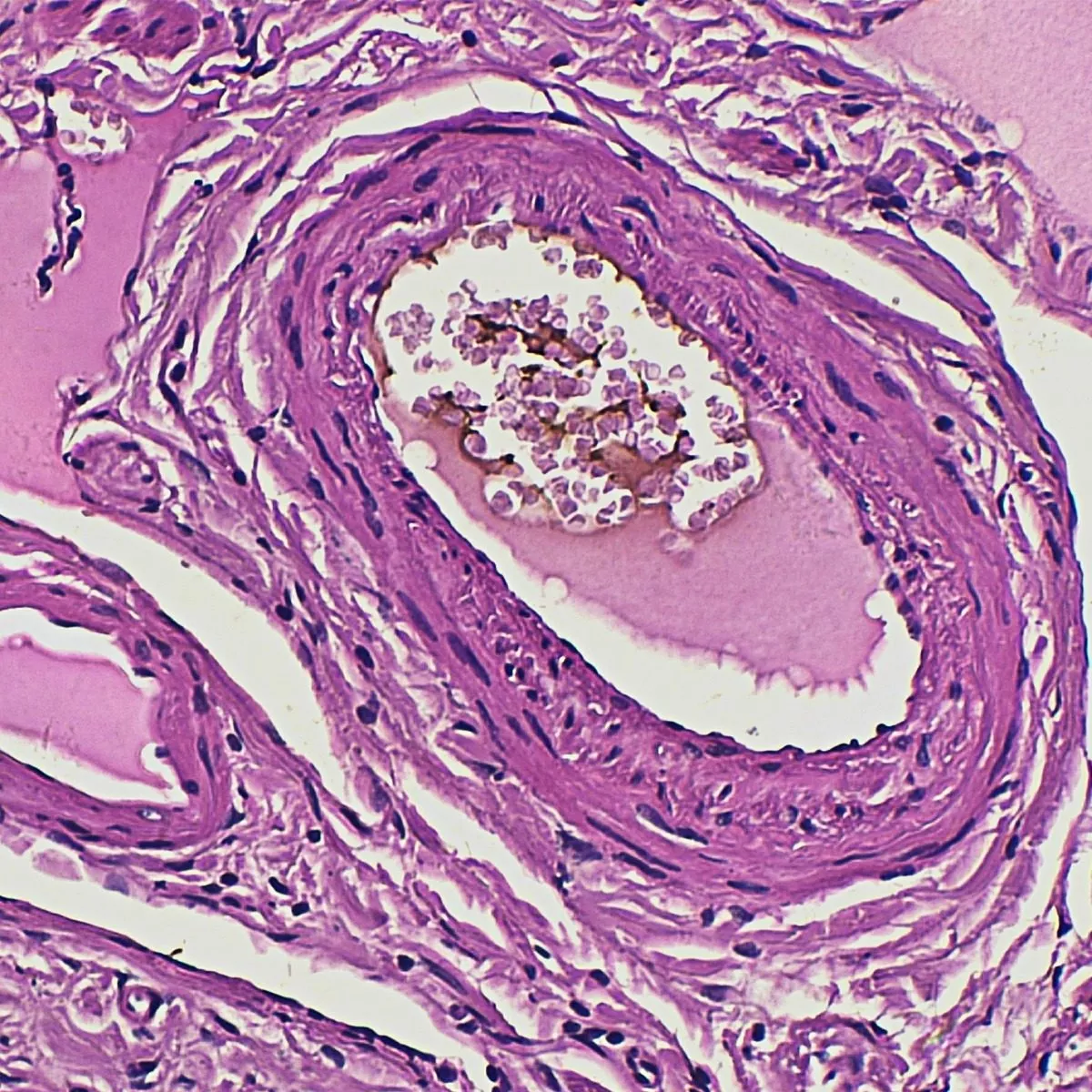 Terceira imagem para pesquisa de laminas preparadas microscopio