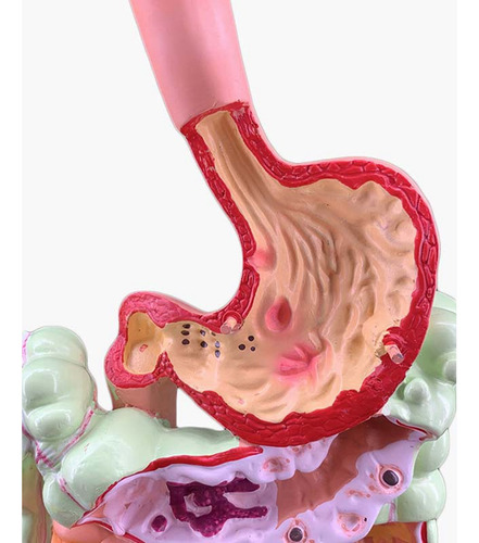 Modelo Do Sistema Digestivo Humano Anatomia Do Estômago Inte