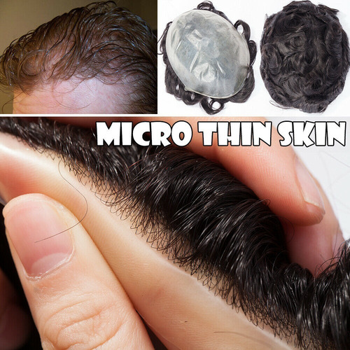 Prótesis Capilar Micro Skin Realmente Indetectable