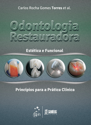 Odontologia Restauradora Estética e Funcional, de Torres. Livraria Santos Editora Comércio e Importação Ltda., capa mole em português, 2013