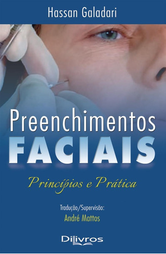 Livro: Preenchimentos Faciais: Princípios E Pratica