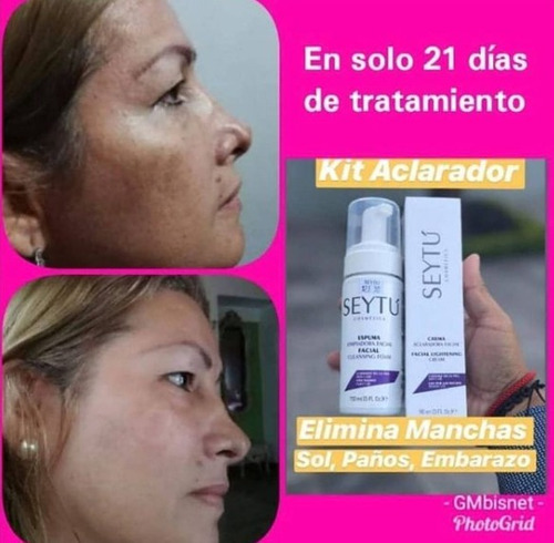 Kit Quita Manchas Seytu Espuma Limpiadora + Crema Aclaradora