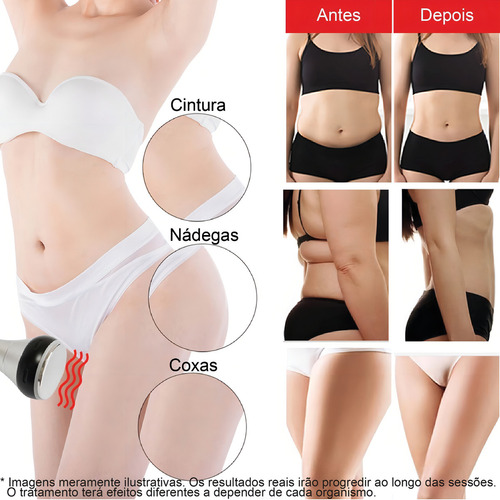 LW 101 Aparelho Lipo Cavitação 40k Ultrassom Manual Em Português