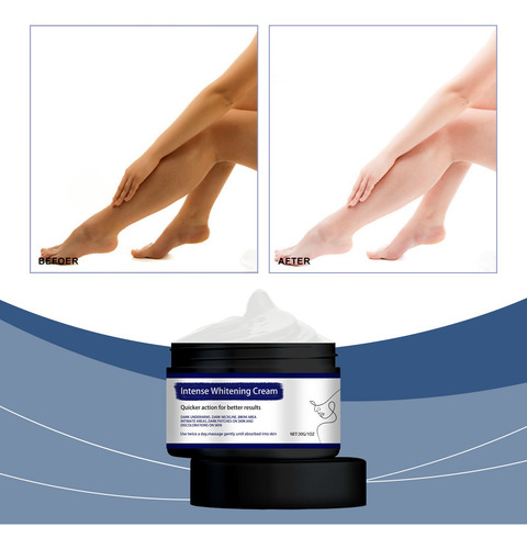 La Crema T Elimina Las Manchas Oscuras, Blanquea El Cuerpo Y