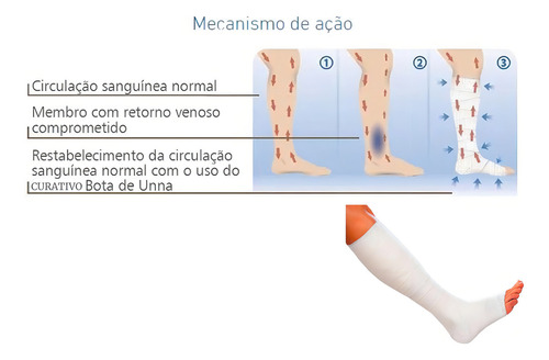 Curativo Bota De Unna C/ Pasta Óxido De Zinco 7,5cm X 9,2m Bota Unna Derma Cure