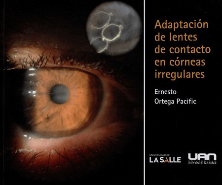 Adaptacion De Lentes De Contacto En Corneas Irregulares