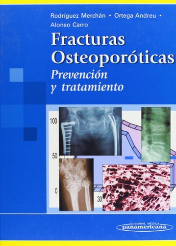 50* Fracturas Osteoporoticas - Rodriguez Merchan