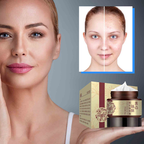 Creme Removedor De Sardas Xifei Cream Melanie Face Cream