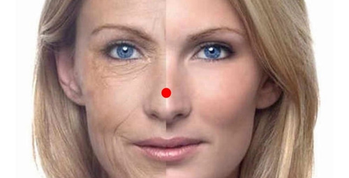 Serum Ac. Hialuronico E Retinol Clareador Manchas