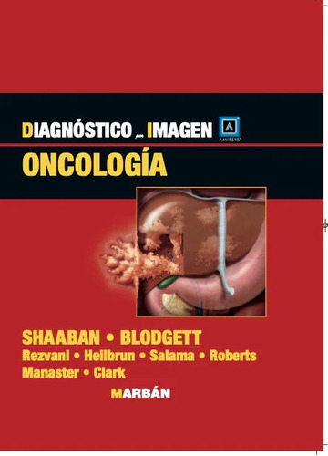 Oncologia. Diagnostico Por Imagen / Shaaban Blodgett