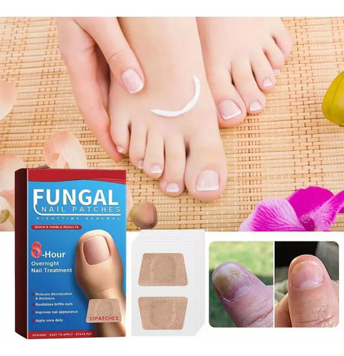 Parches Nocturnos Para Uñas Con Hongos