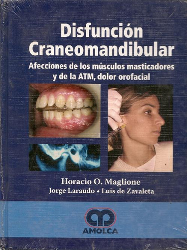 Libro Disfunción Craneomandibular De Horacio O. Maglione, Jo