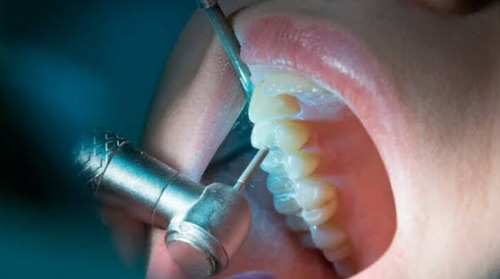 Imagem 5 de 5 de Tratamento Dentário No Boleto.